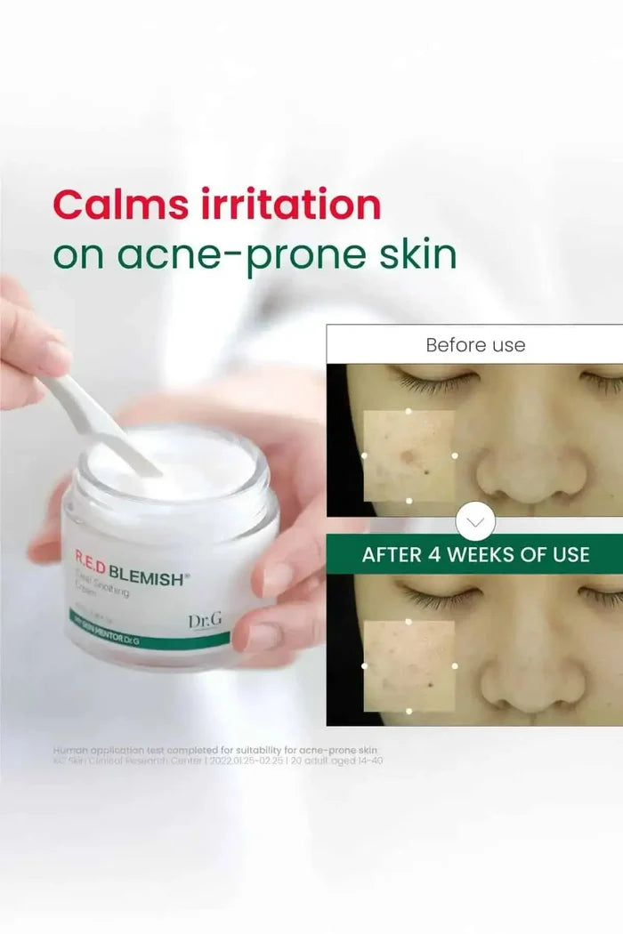 Clinical results showing how this non-comedogenic moisturizer effectively calms irritation and redness on acne-prone skin.