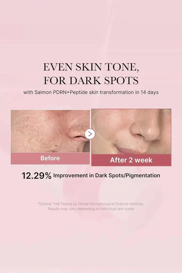 Before and after results showing a 12.29% improvement in dark spots and pigmentation after 14 days.