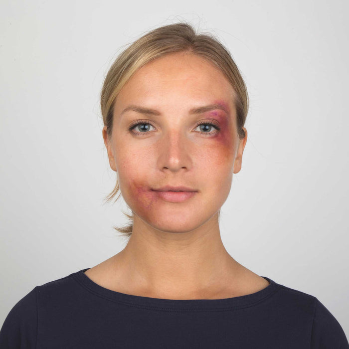 Model with subtle bruise SFX makeup applied with Starter Effects Kit